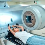 radiotherapie
