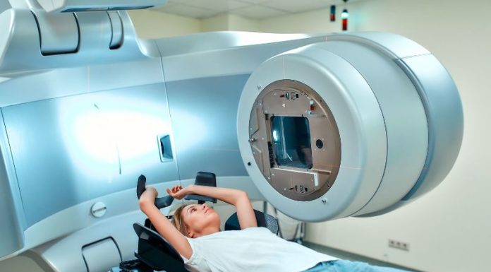 radiotherapie