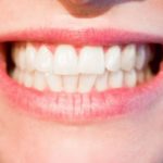 Comment soulager les lèvres gercées