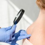 Consulter un dermatologue : pourquoi, quand et comment ?