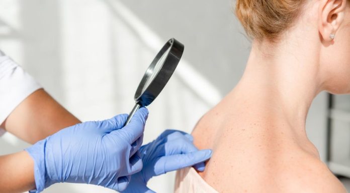 Consulter un dermatologue : pourquoi, quand et comment ?