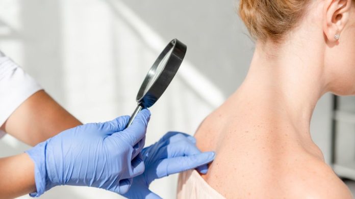 Consulter un dermatologue : pourquoi, quand et comment ?