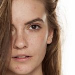 Que faire pour venir à bout des imperfections cutanées ?