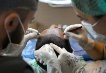la greffe de cheveux pour éviter les conséquences psychologiques