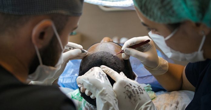 la greffe de cheveux pour éviter les conséquences psychologiques