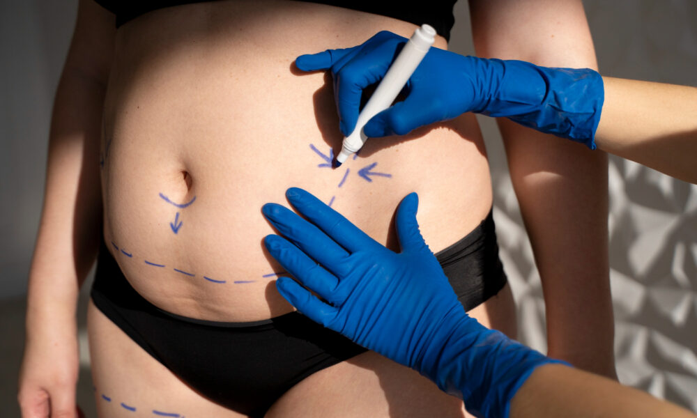 chirurgie esthétique