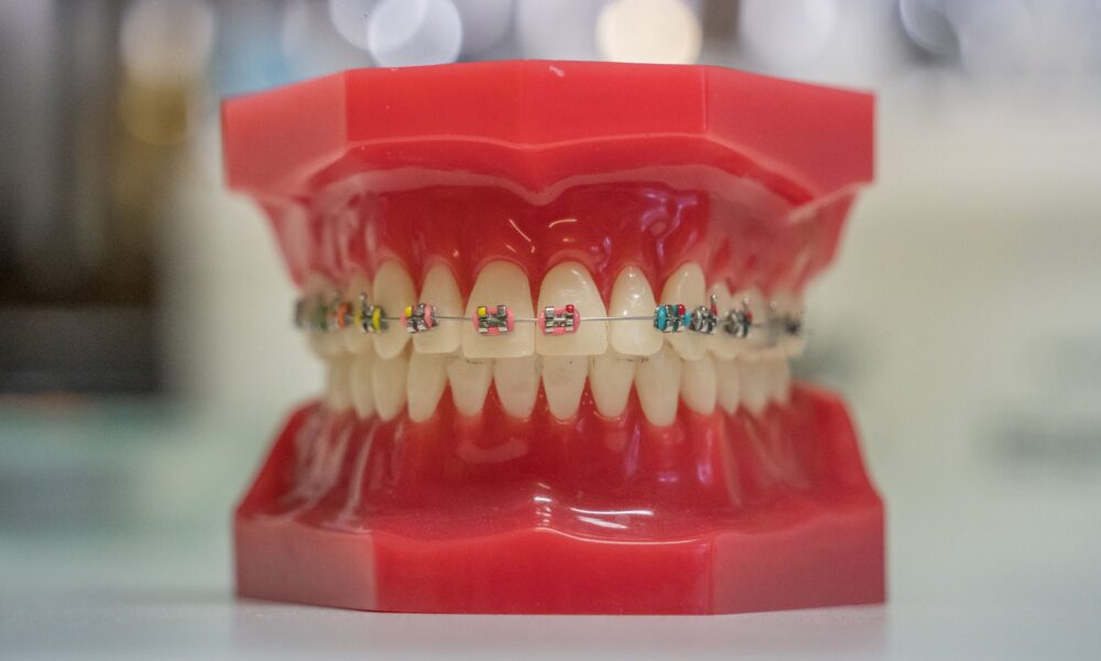 dents