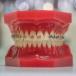dents