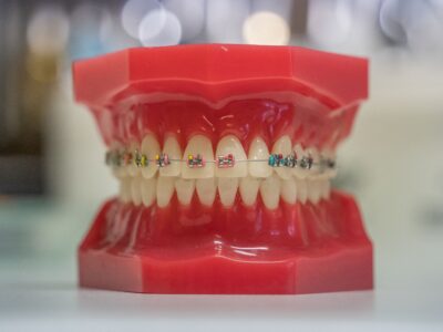 dents